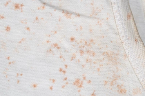 Pink Mold On Clothes