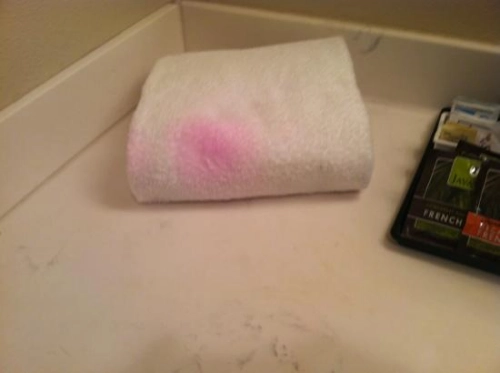 Pink Mold On Towels